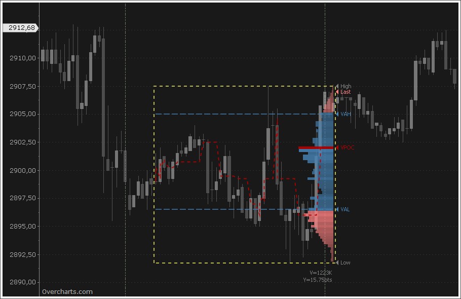 Free Market Profile Charts Online